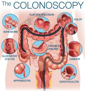Prevalence of Screening Colonoscopy among the First-Degree Relatives of Patients with Colorectal Cancer and Related Factors